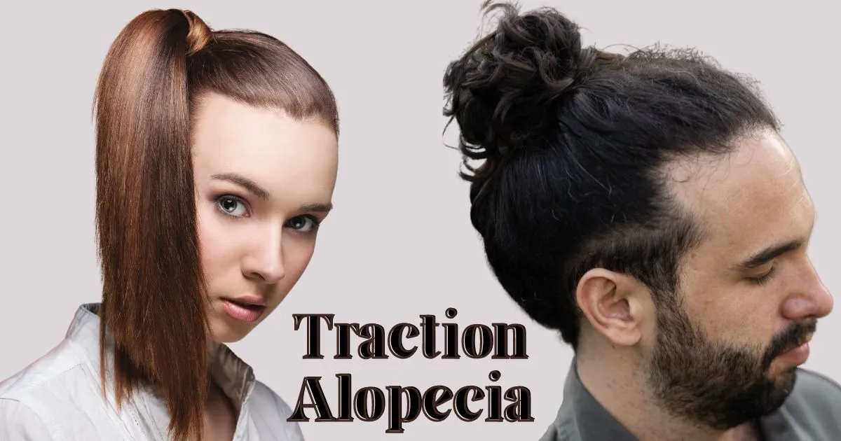 Traction Alopecia- caused by repeated or chronic pulling force applied to your hair. 